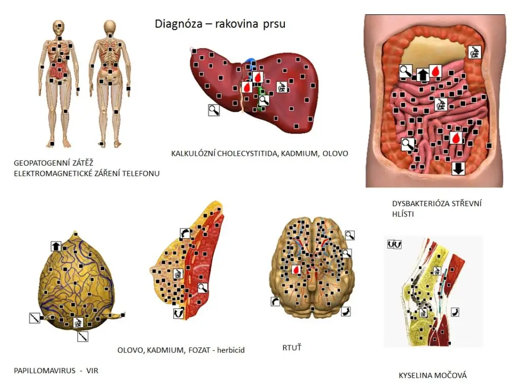 Sensitiv Imago 530 biorezonancia 3 imago1