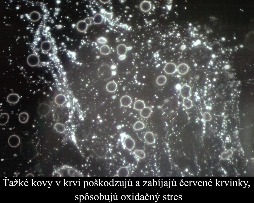 tazke kovy krv edit3