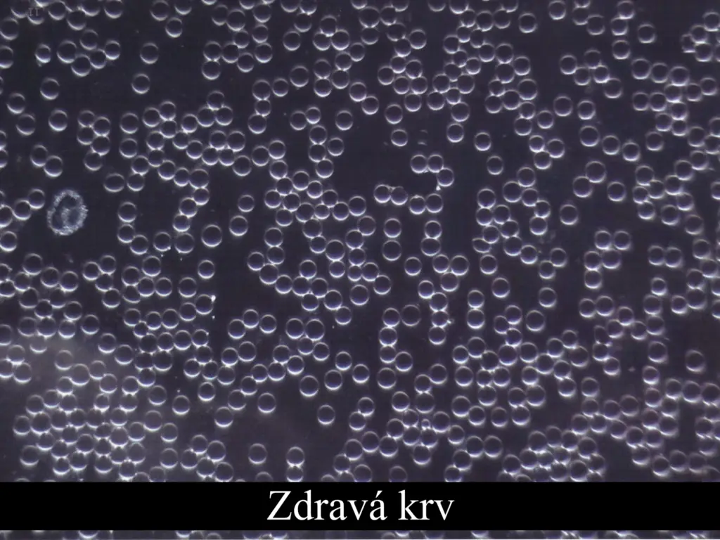 zdrava krv3