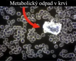 metabolicky odpad