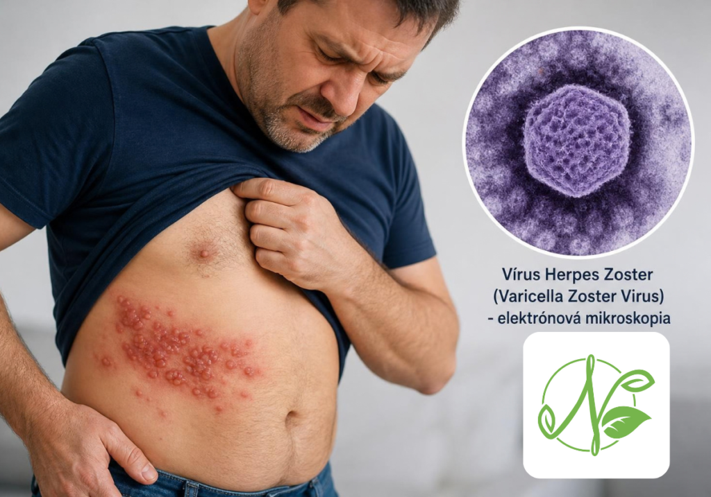 Pásový opar (herpes zoster) je infekčné ochorenie spôsobené reaktiváciou vírusu varicella-zoster