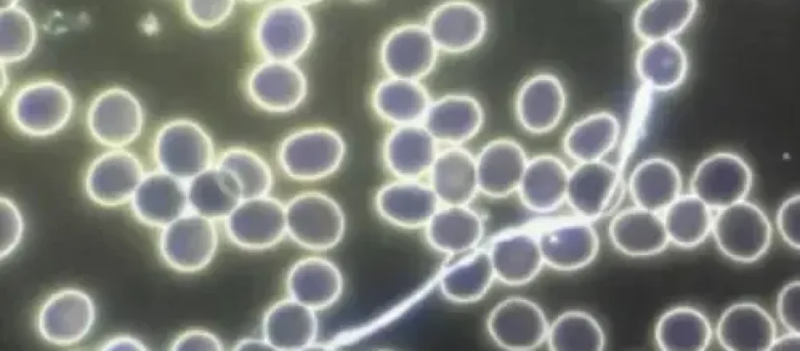 obr2